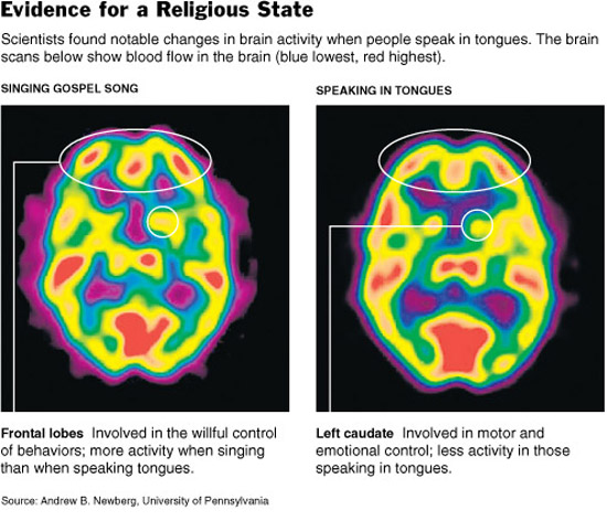 compared monolingual brain bilingual brain